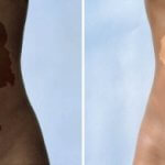 Two photos of abdomens with silhouettes of Germany and Africa sunburned on